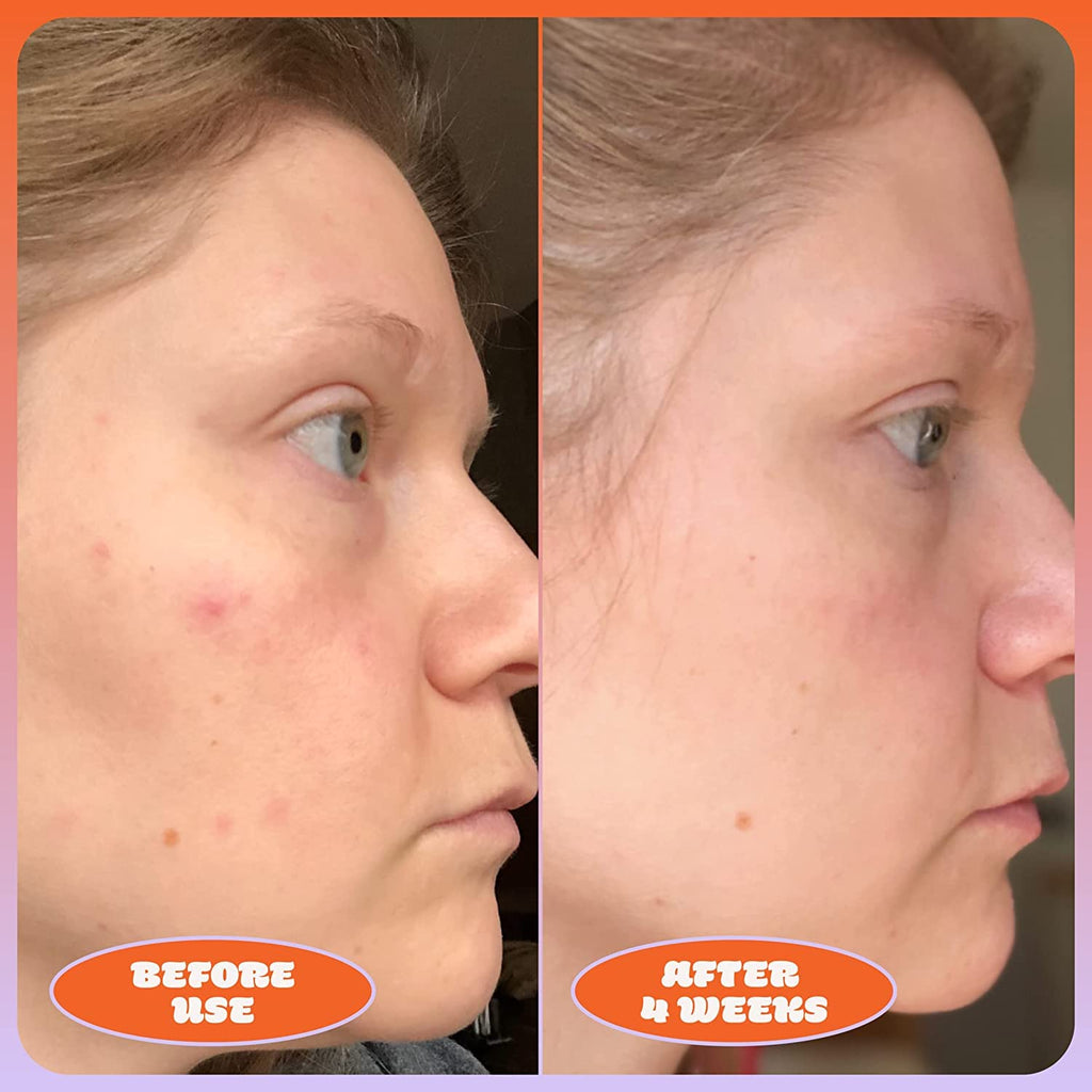 Vitamin C Serum and Blue Tansy Face Oil Duo R144787